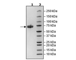 ACHE, His-Tag Recombinant