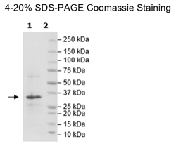 MCL-1 His-Tag (Mouse) Recombinant