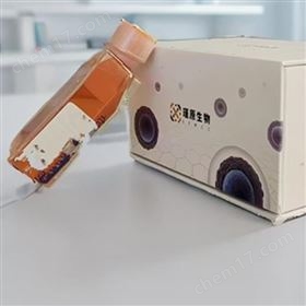 人肺鱗癌細胞HCC95(STR鑒定正確)