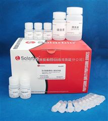 D1140-50Solarbio-去内毒素质粒小量提取试剂盒