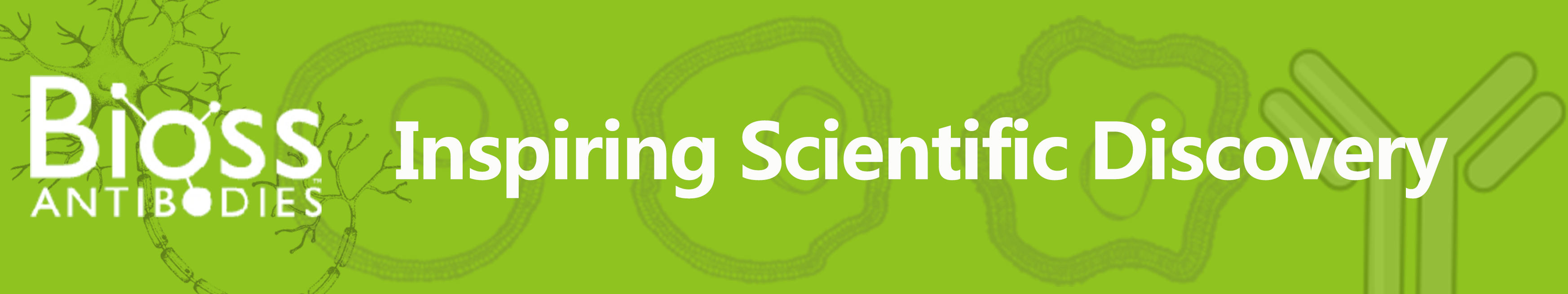 【10月文献战报】Bioss 抗体新增高分文献精彩呈现