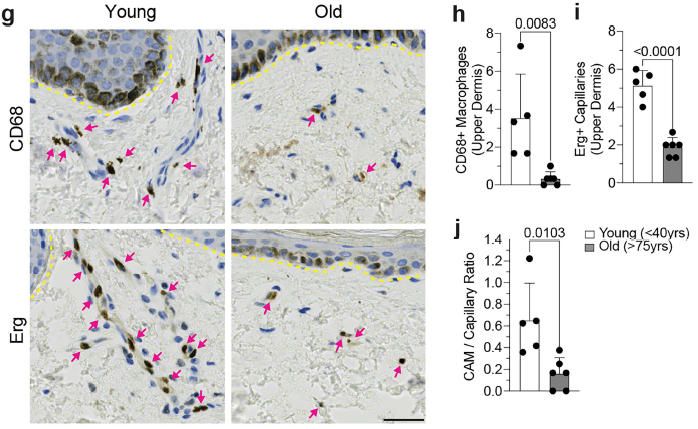 20251015-nature-depletion-data3 《Nature》:真皮巨噬細(xì)胞缺失促進(jìn)皮膚毛細(xì)血管衰老