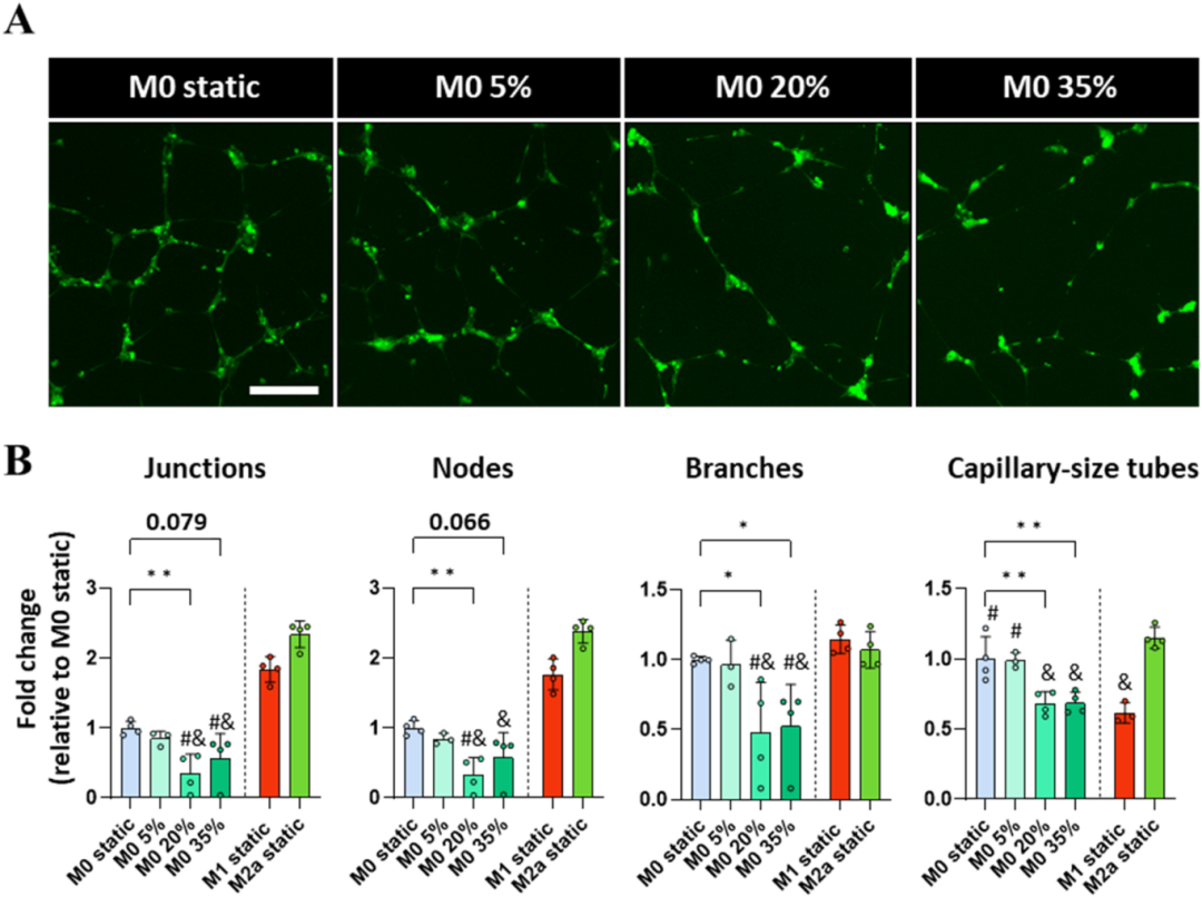 巨噬细胞的机械免疫调节通过调节血管生成和成骨作用影响骨折愈合的再生环境