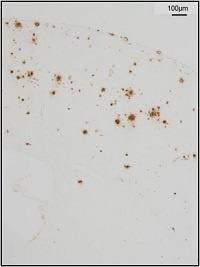 抗β-淀粉樣蛋白抗體