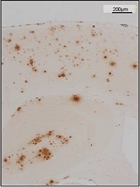 抗β-淀粉樣蛋白抗體